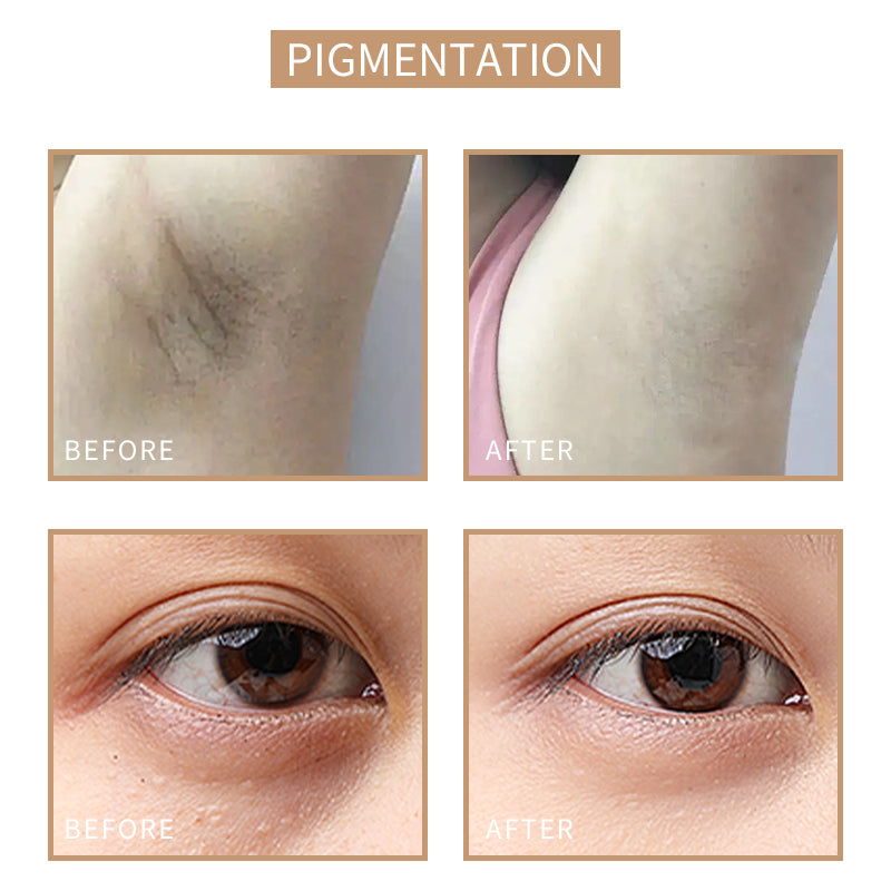 [Sober Skin] Skin Tone Reconstruction Lotion 10ml Semi-Permanent Color Tattoo Pigment Used To Cover Scars, Dark Circles, Stretch Marks, Growth Lines, White Spots