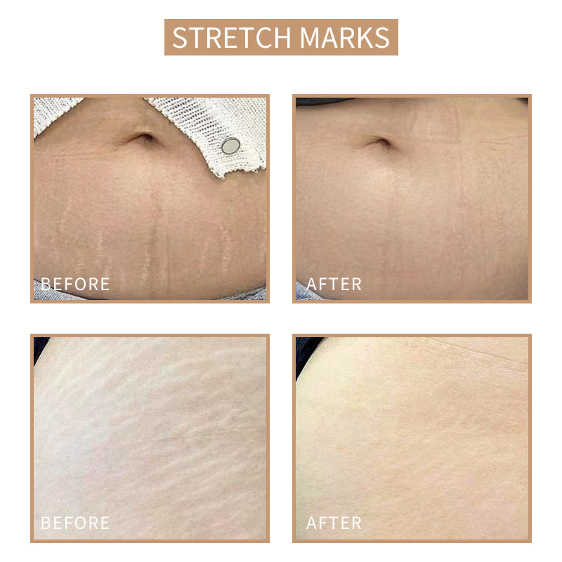 [Sober Skin] Skin Tone Reconstruction Lotion 10ml Semi-Permanent Color Tattoo Pigment Used To Cover Scars, Dark Circles, Stretch Marks, Growth Lines, White Spots
