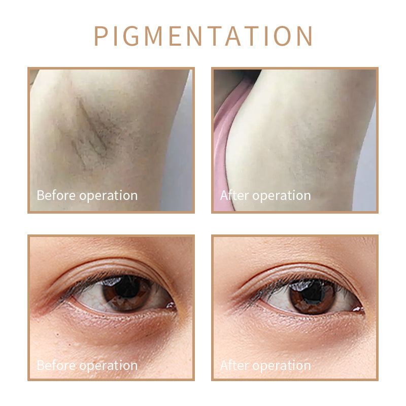 wholesale private label permanent makeup professional permanent makeup kit for stretch mark cover