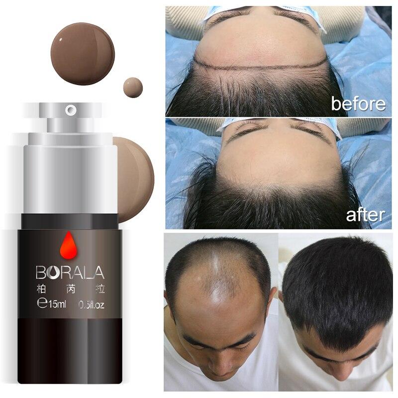 Borala Tattoo hairline Pigment for Hair Scalp pigmentation Tattoo Microblading&Machine Operation Super cost-effective